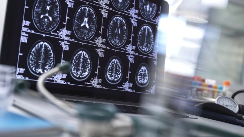 Planos de saúde têm recuperação no 1º tri, acumulando R$ 4,4 bi nos últimos 12 meses