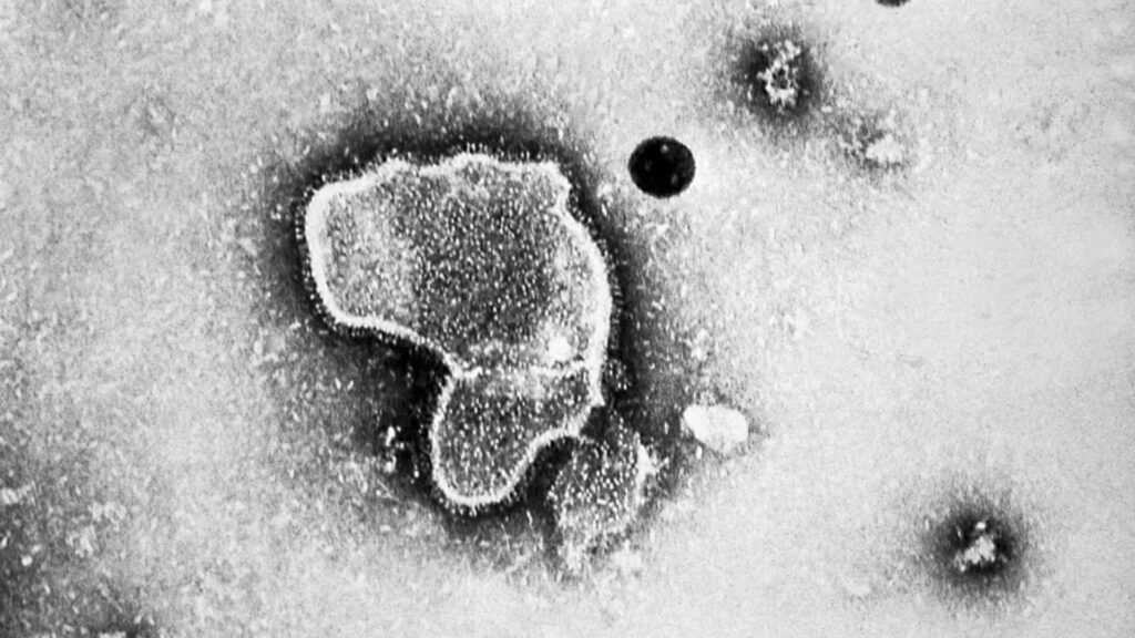 Vírus respiratório que pode causar pneumonia acende alerta na China – Jornal Advogado – Em Mato Grosso